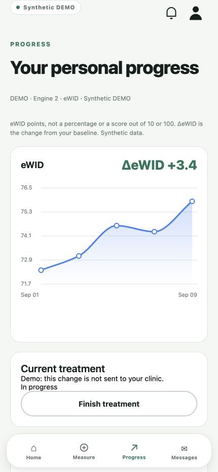 Current Chromic mobile app Progress interface in English, with an eWID graph, ongoing treatment and fictional data labelled Synthetic DEMO.
